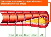 судин