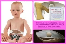 Пупкова грижа у новонароджених симптоми, причини, лікування (з відео) лікування