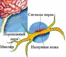 захворювання