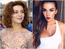 українські знаменитості, схиблені на пластиці, яких не впізнати на старих фото пластиці