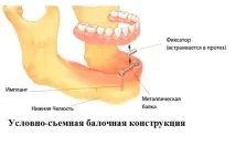 редица