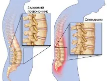 хребта