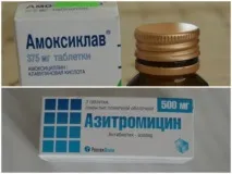 Ангіна при грудному вигодовуванні чим лікувати маму і як убезпечити дитину ангіна
