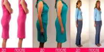 Боді корсет Друга Шкіра відгуки, ціна, розміри шкіра