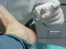 Блокада п’яткової шпори укол (відео). блокада