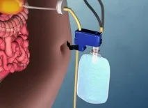 сечового