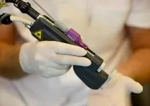 Епіляція неодимовим лазером як діє, переваги, недоліки, ціни та відгуки неодимовим