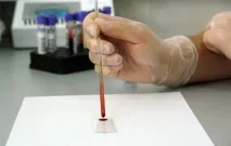 Гіпохромія у загальному аналізі крові показники, розшифровка аналізі