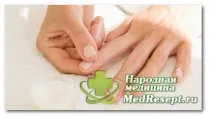 Грибок нігтів на руках – далеко не косметичний дефект руках