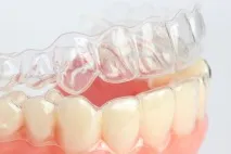 invisalign