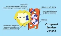 Кишкова мікробіота та діабет 2 типу типу