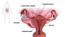 Місячні коричневі причини, чому місячні коричневого кольору, чорні, густі виділення, чому