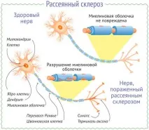 лечение