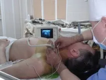 Регіонарна анестезія під контролем УЗД контролем