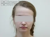 лікування