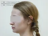 лікування