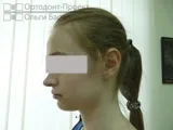 ретинований