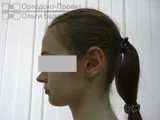 видаляти