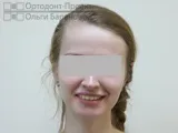 зубів