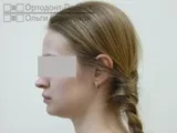 лікування