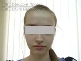 зубів