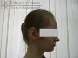 видаляти