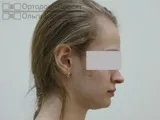 видаляти