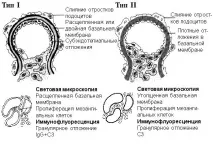 синдром