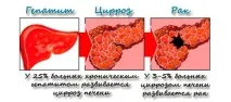 Скільки живуть із раком печінки – прогнози стадій раку печінки