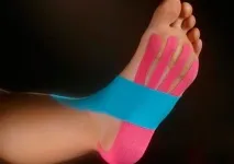 накладати