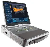 Viamo SSA-640A Toshiba medical, Портативний ультразвуковий сканер - новий стандарт у портативному toshiba