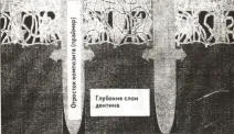 Адгезивні системи адгезивні