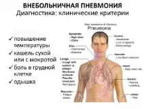 симптоми