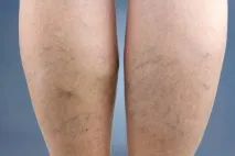 архіви