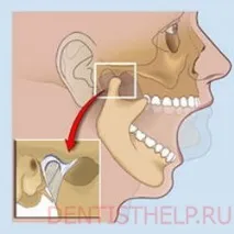 темпоромандибуларната