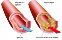 Аторіс: опис, інструкція, відгуки відгуки