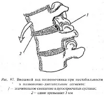 сегмента