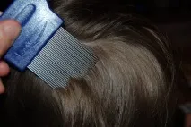 Гребінець для вичісування гнид спеціальна гребінець від вошей, що це таке, як вибрати, а також чим вичісування