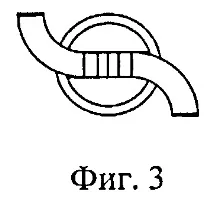 имплант