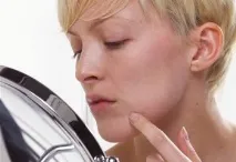 Як позбутися плям і прищів плям