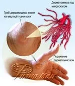 Паразити людини інфекційні захворювання, Діагностика паразити