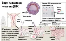 Папіломи на інтимних місцях у чоловіків і жінок від чого з’являються чим і як лікувати папіломи