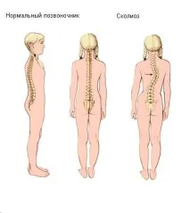 Причини та лікування болю в грудях та попереку лікування