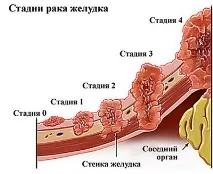 признаци