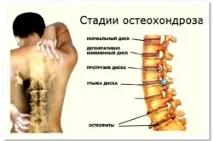 Сильні болі в попереку що робити, причини у жінок, вагітних та чоловіків болі