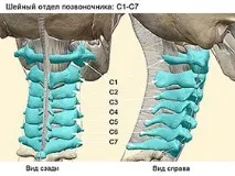 Симптоми остеохондрозу шиї язів