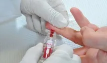 Стеноз ниркової артерії симптоми та лікування артерії