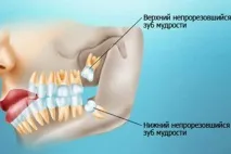 Стоматологія Приморського району СПб – «Імідж дент» на проспекті Корольова проспекті