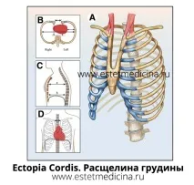 Типи деформації грудної клітки, Інтернет-журнал клітки