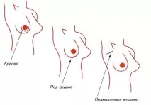 встановлення